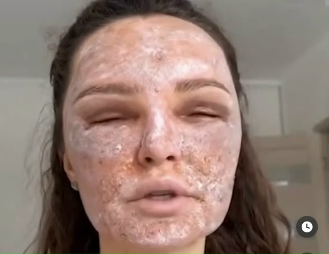 ⚡️ Россиянки МАССОВО УРОДУЮТ себя после лазерной шли?...