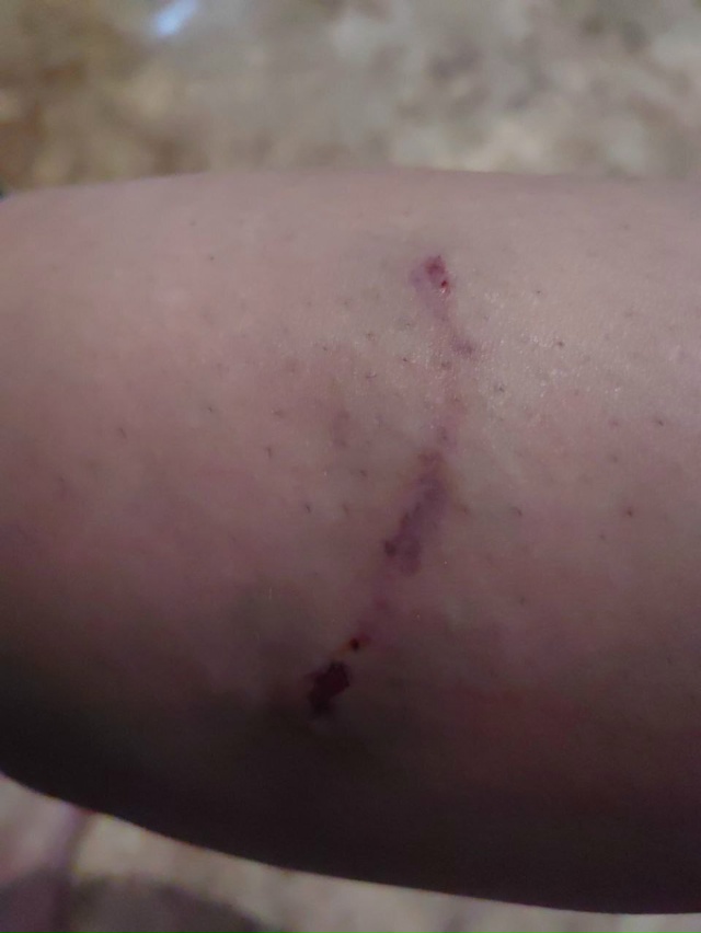 🐕 В Орске бездомная собака напала на беременную женщи...