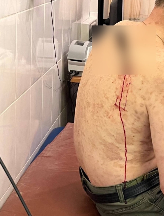 ⚡️Пассажирка ударила таксиста ножом в спину из-за 190 р...