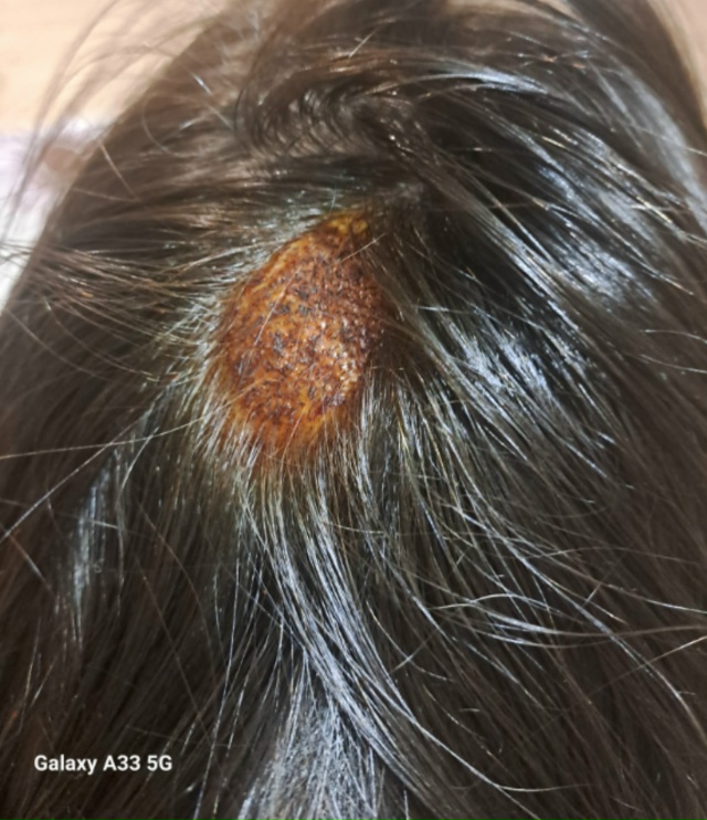 Здравствуйте, в платной больнице не знают что это! Наз?...