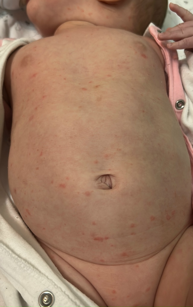 SOS‼️помогите, пожалуйста, вpачи не могут сказать что э?...