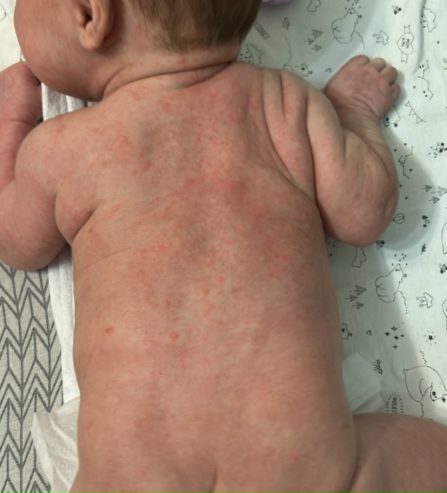 SOS‼️помогите, пожалуйста, вpачи не могут сказать что э?...