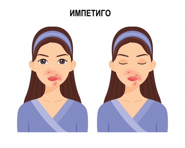 💋 Целоваться с бородачами — ОПАСНО. Из-за этого можно ...