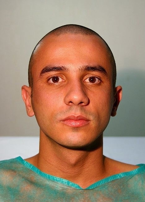 Родриго Брага из Бразилии подверг себя операции для то...