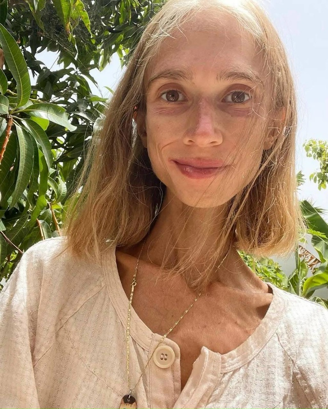 Скончалась женщина, которая ела одни фрукты: на момент ...