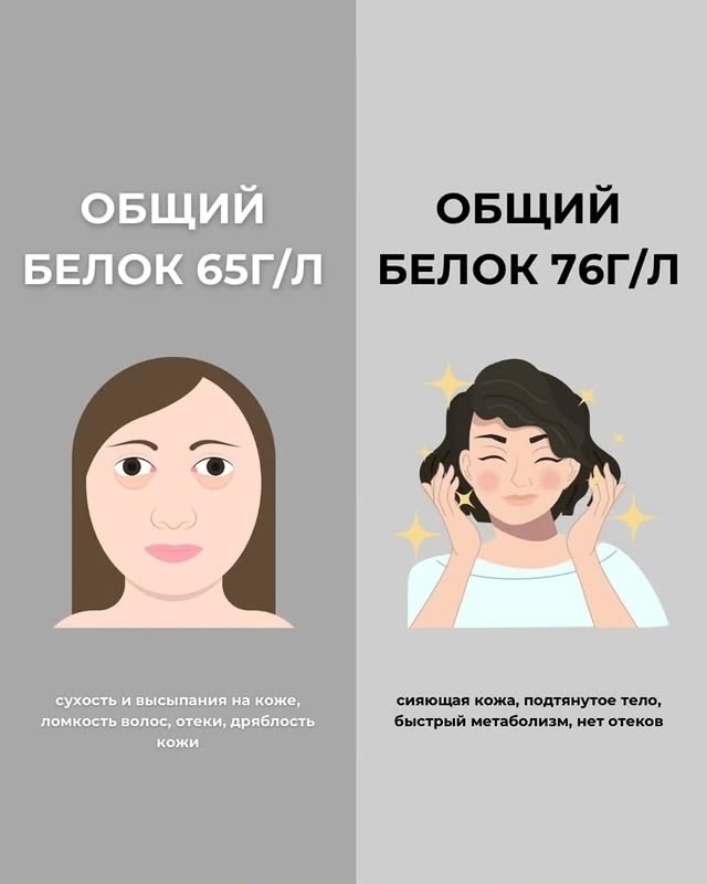 ПРИЗНАКИ НЕХВАТКИ ВИТАМИНОВ: КАК ПОНЯТЬ, КАКИХ ВИТАМИН...