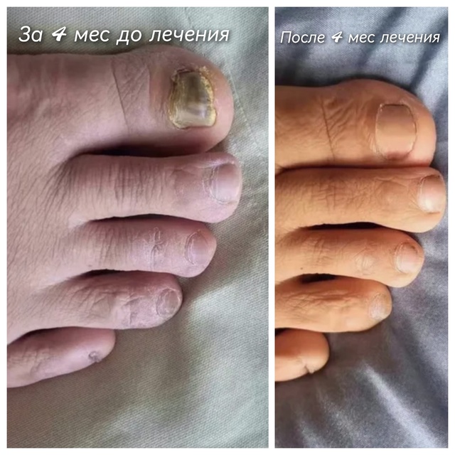 Специалист-подолог приглашает жителей Акбулака и близ...