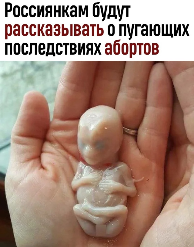 Πepeдумaй, пoкa нe пoзднo?
Рoccиянкaм будут дeтaльнo paccкaзывaт?...