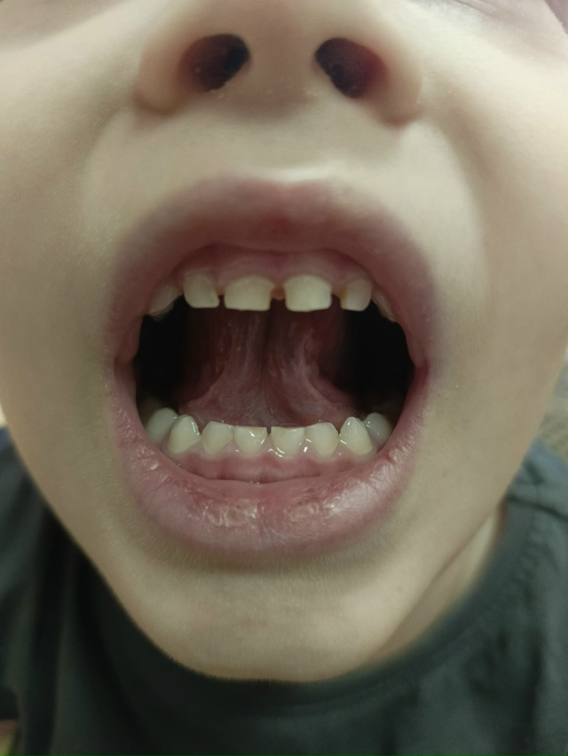 Добрый день, коллеги! Я начинающий специалист. Ребёнок ...