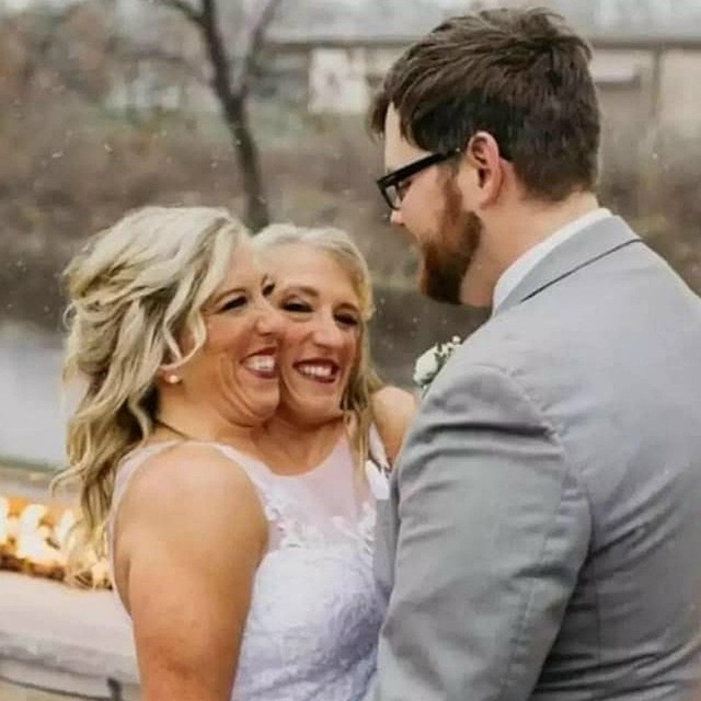 Сиамские близнецы вышли замуж. Точнее, одна из них😅
В ...