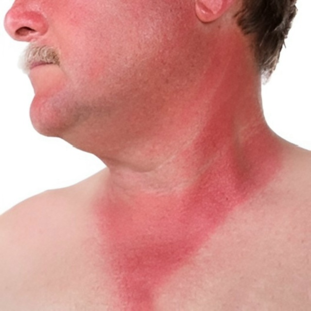 👉В Смоленской области 5 человек подхватили «мышиную б...