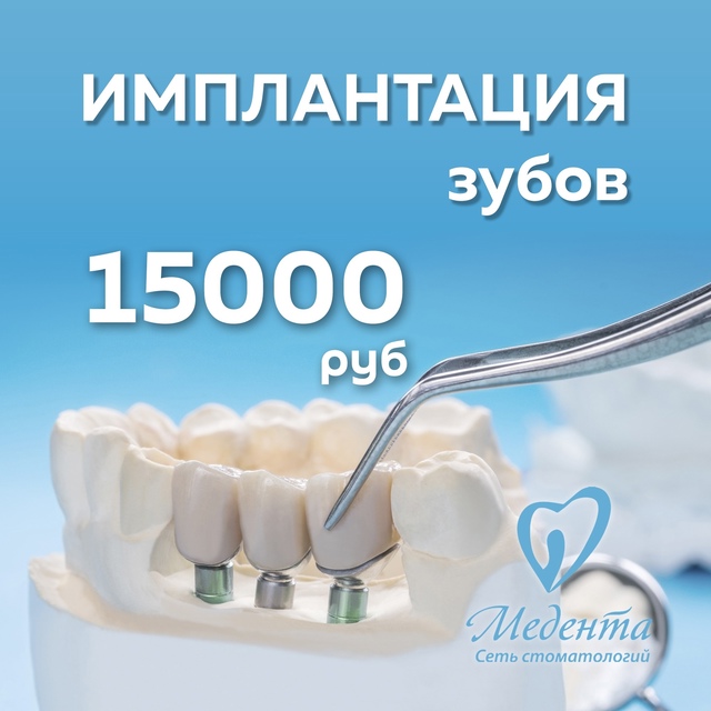 Цены под ключ / Все включено
✅ Акция* Профессиональной ...