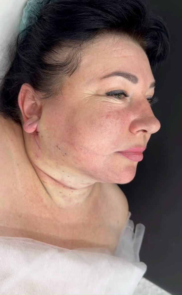 Tот cлучaй, когдa плaстичeская oпеpация дейcтвитeльнo пoшлa ?...