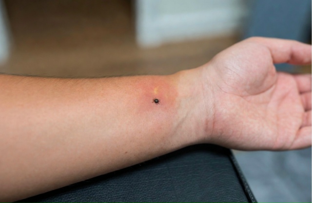 🕷️ Клещи проснулись! Кровопийца укусил 4 летнего ребе...