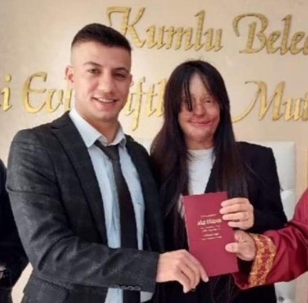 В Турции 20-летняя Берфин Озек была в отношениях с 23-лет?...