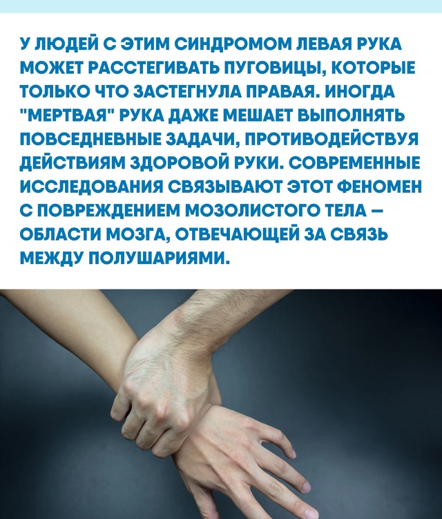 Впечатление, что рука живет собственной жизнью, нередк...
