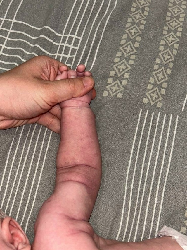 В детской поликлинике работают живодеры! Малышу 2х мес?...