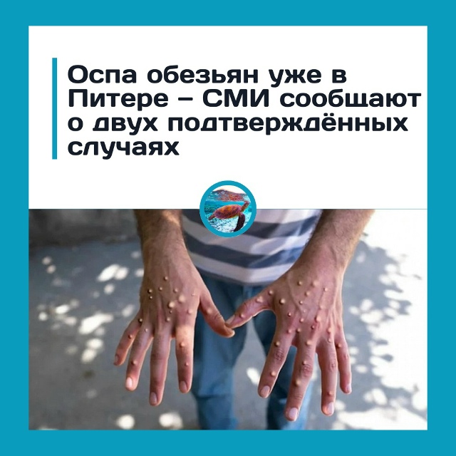 Оспа обезьян уже в России! Врачи подтвердили новые слу?...