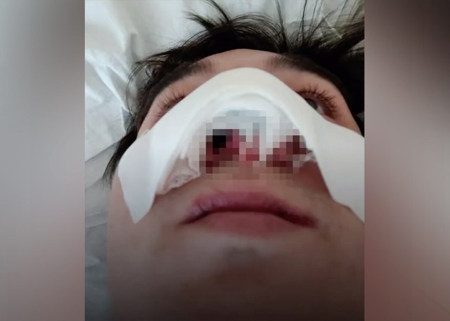 👃🏻В Башкирии, в Илишевском районе, друг откусил мужи?...
