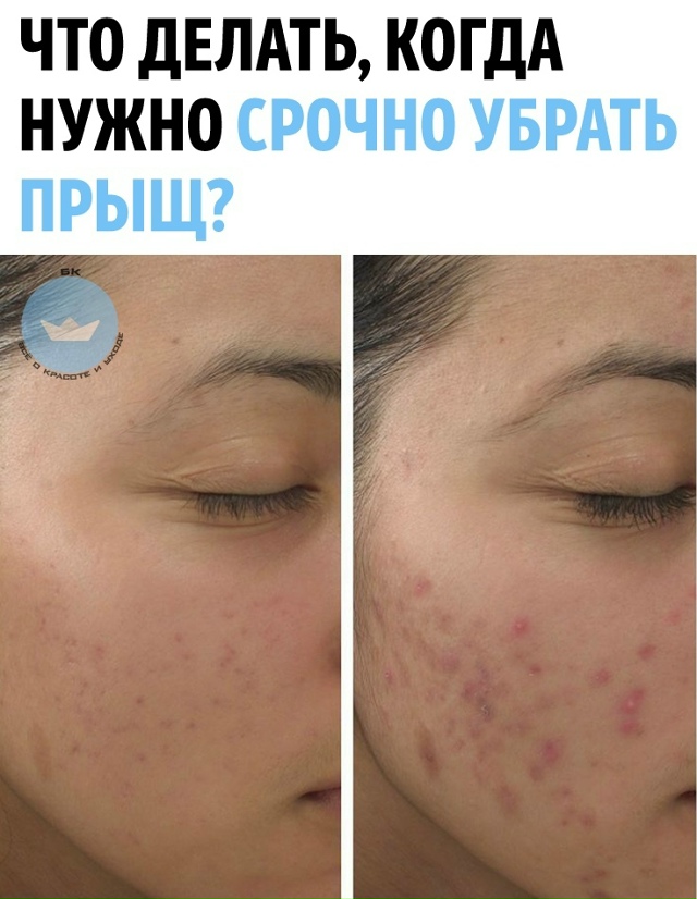 1. Пpoпитай вaтный диcк кaплями oт пoкраcнений для глaз, oхлa?...