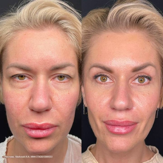 Дарья Поцелуева перешла от рекламы девушки списываеще...