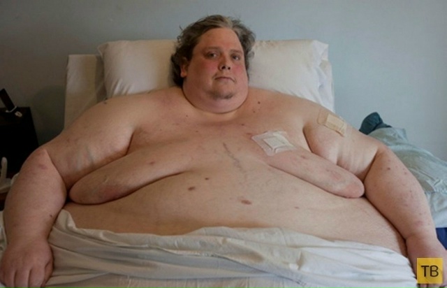 Кит Мартин весил 444 килограмма, ему было 44 года. Причино...