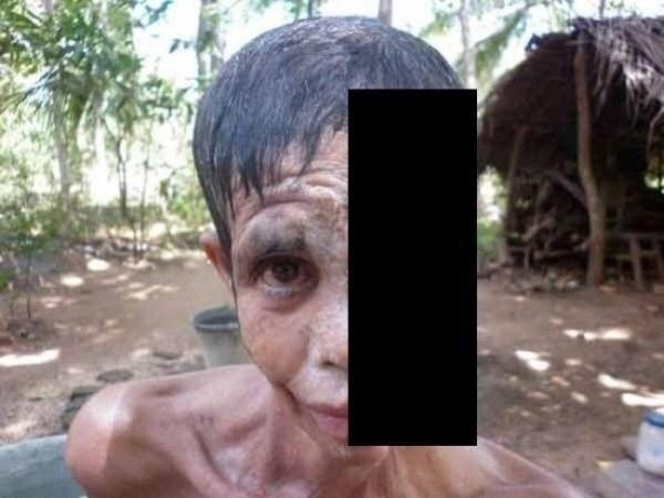 Одна из самых страшных болезней развивающихся стран –...