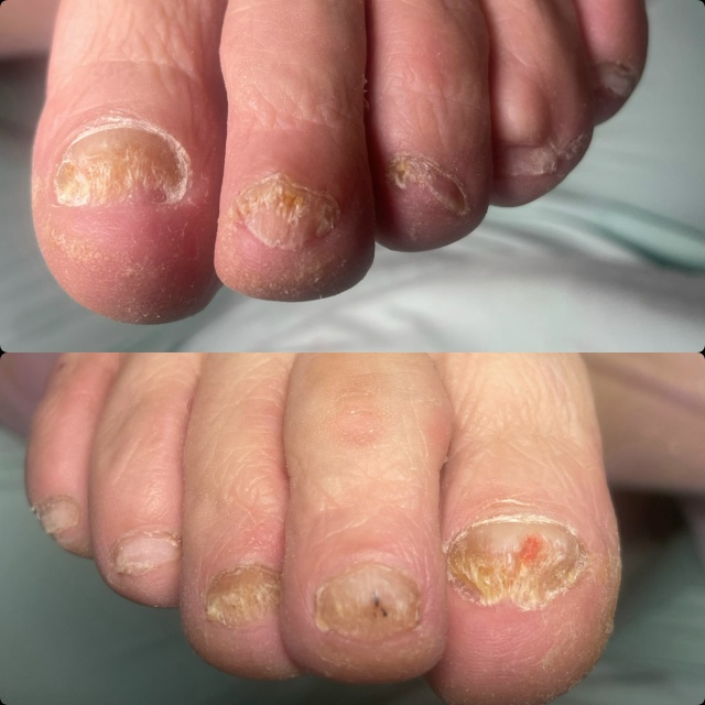 Добрый день!
С 14.11-16.11 ведет прием Нижегородский подоло?...