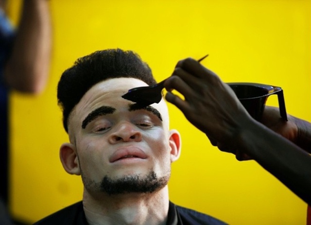 Оорганизация Albinism Society of Kenya, которая спасает альбиносо...