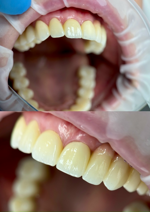 СТОМАТОЛОГИЯ Эмидент ? 8-800-555-73-67 • nfk.emident.ru
? Нефтека...