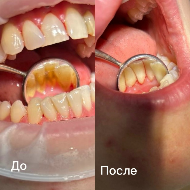 🌟 Стоматология «Академия Улыбки» приглашает вас! 🌟
?...