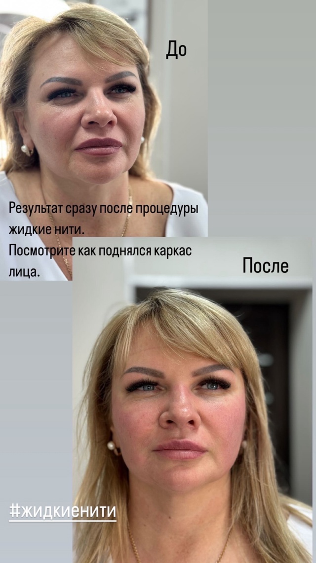 ✨ 20 июля — приём в Александровке! ✨
⠀
Косметологическ...