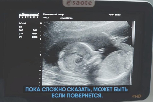 Вот почему большинство мужчин на УЗИ и не ходит😂