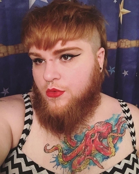 26-летняя Нова Галаксия страдает от поликистозного син?...