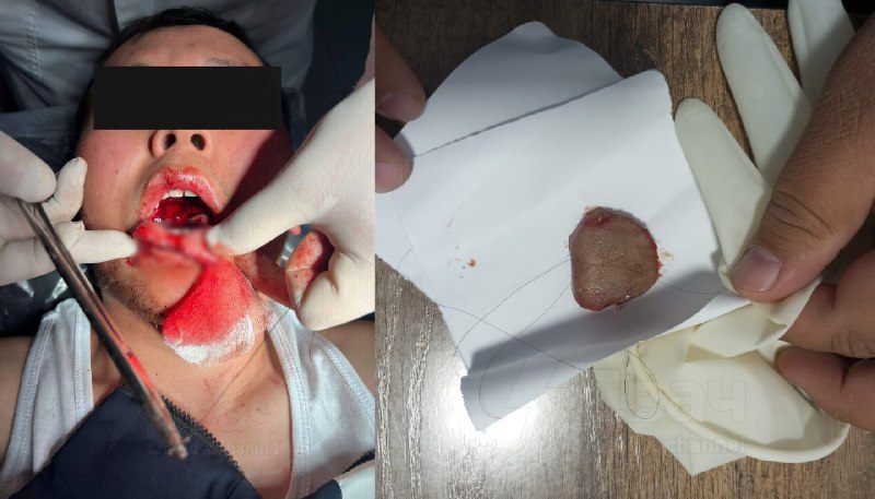 В Киргизии тян откусила парню язык во время поцелуя
Это произошло на свадьбе их общего друга: 26-ле