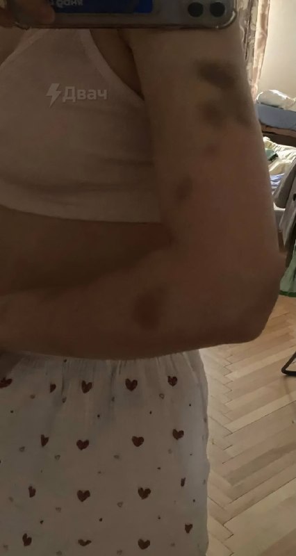 Я сказал отвечай мне на звонок, Я СТРАДАЮ, ОТВЕТЬ!
Студент РАНХиГС избил свою мать селфи-палкой из-