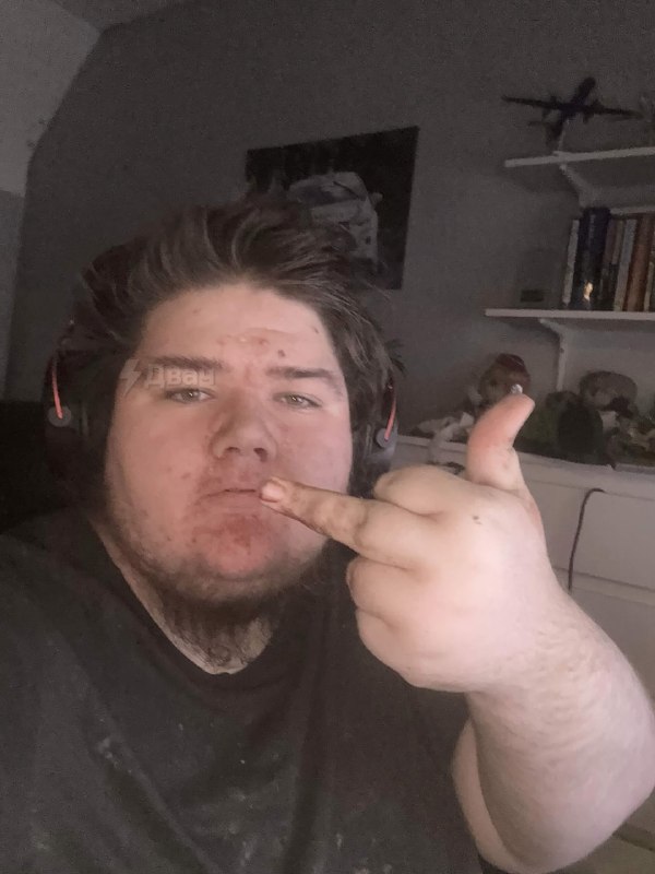 Один из лучших игроков по Fortnite — чухан, который буквально гниёт заживо
Игрун под ником TernsChe