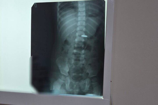 ⚡️⚡️ «Мгновенный урон»: врачи из балаковской больни?...