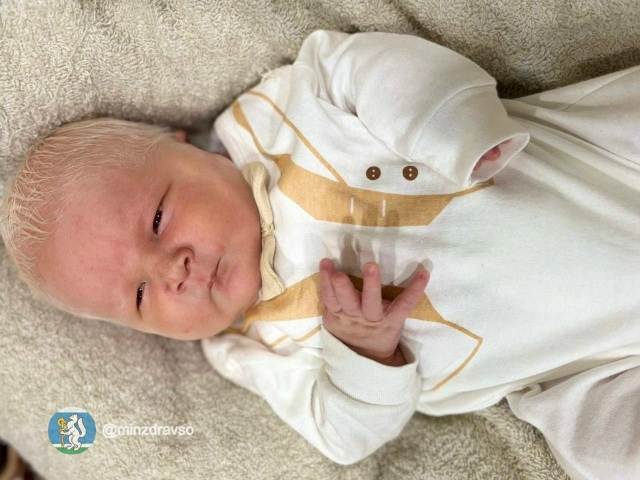 Мальчик-альбинос с «глазами цвета граната» родился в Н...