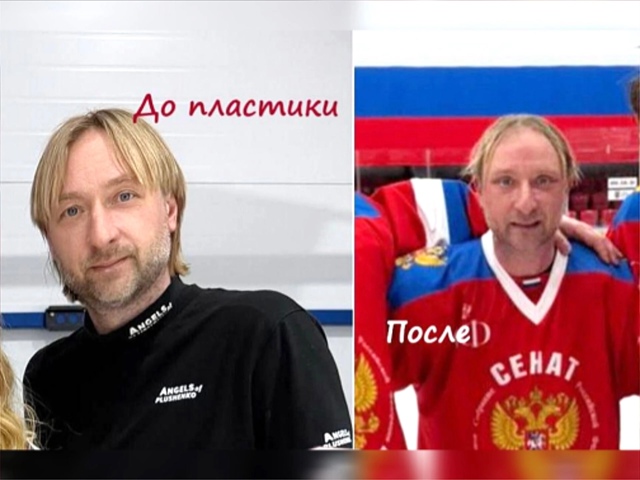 🔪 Как изменился ПЛЮЩЕНКО после пластической операции...