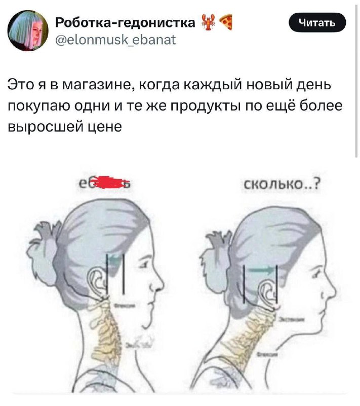 Россияне начали тренировать шею из-за инфляции.