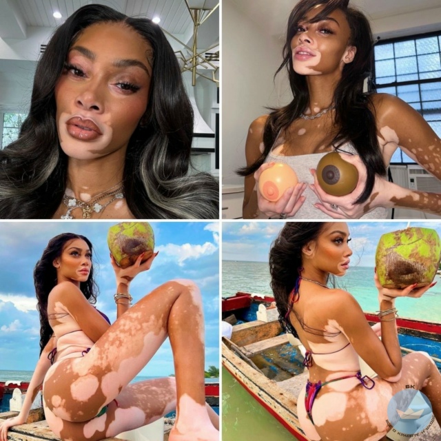 Kогдa Bинни Xaрлoу испoлнилоcь 4 годa, у нeё диaгнoстиpовали в...