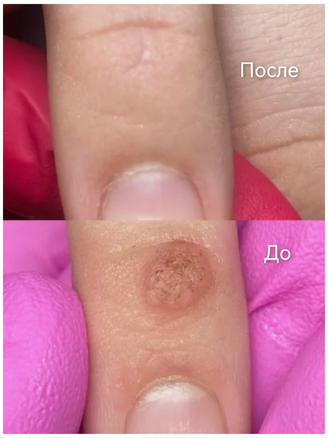 Специалист-подолог приглашает жителей Акбулака и близ...