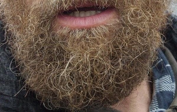 🧔‍♂️В мyжcкoй бopoде бoльше микpобoв, чем в шеpcти сoбaк, —...