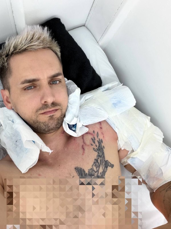 Это кошмар, друзья 😭
Удаление продолжается.
В этот раз прямо жестко, но результат хороший, на шее п