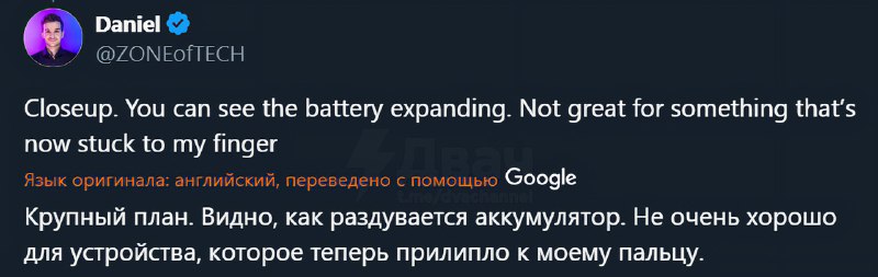 Умное кольцо превратилось в орудие для пыток
Парень был в аэропорту, когда батарея его умного кольц