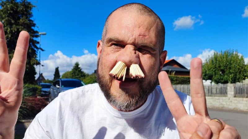 Швед засунул 81 спичку в нос и попал в Книгу рекордов Гиннесса.
На рекорд его вдохновили собственн