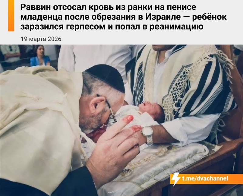 😶😶😶😶В Израиле раввин отсосал кровь из ранки на пенисе младенца после обрезания, из-за чего ребёнок з