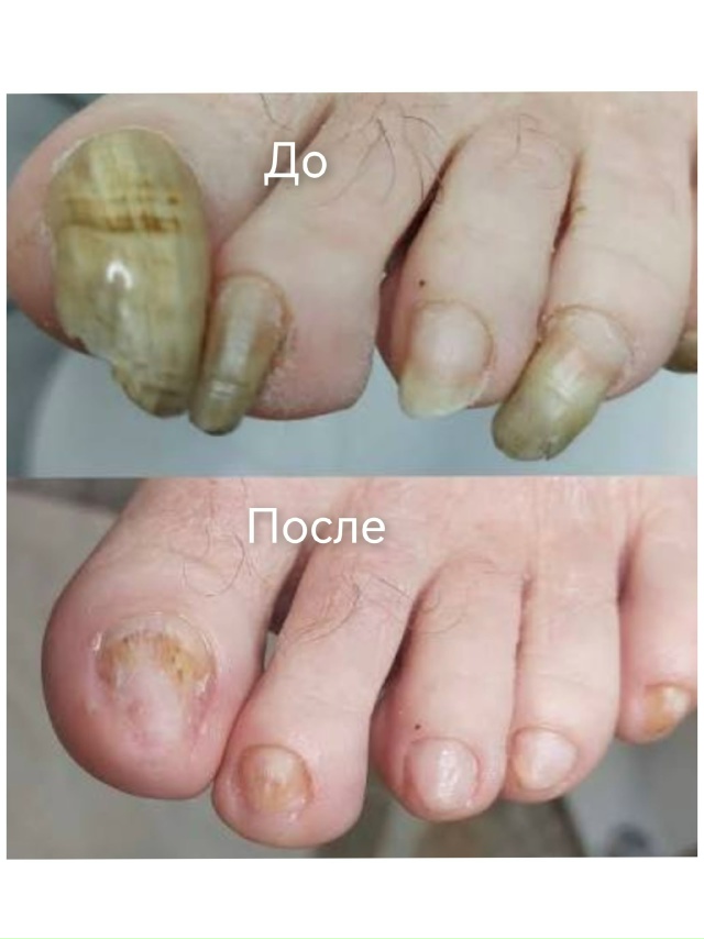 Специалист-подолог приглашает жителей Акбулака и близ...