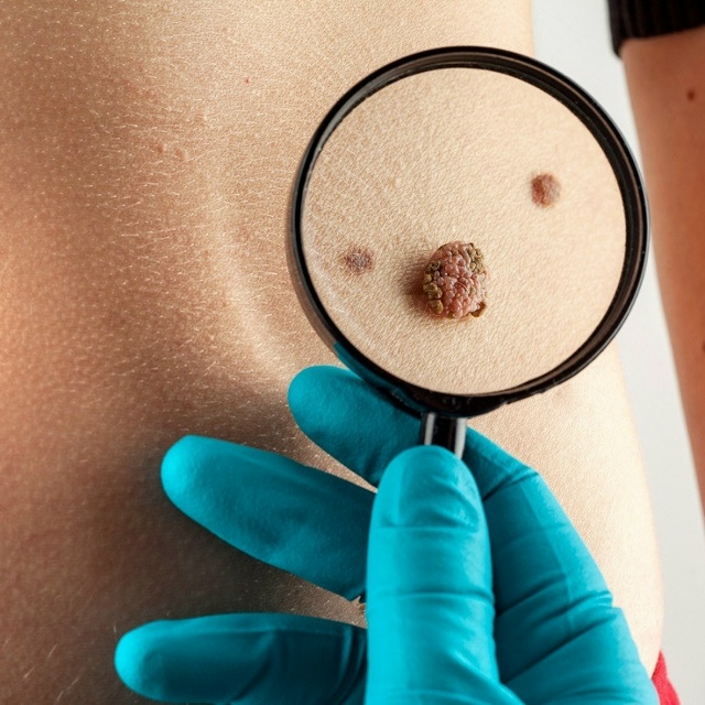 Первые пациенты получат индивидуально созданные лека?...